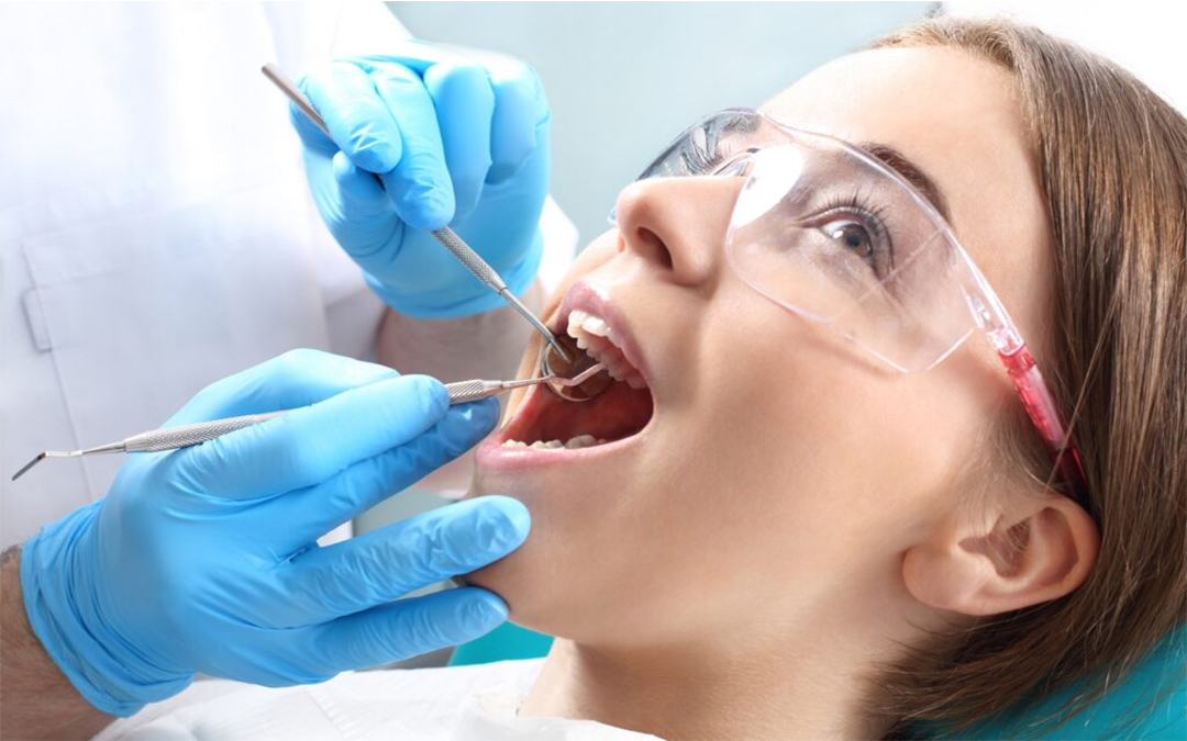 Expert Tips for Oral Care Post Dental Fillings/Restorations by Toothway Dental