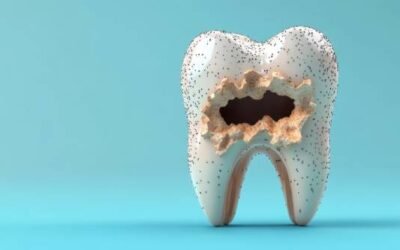 Cracked Tooth Treatment