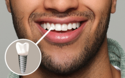 Oral Care Post Implant Placement