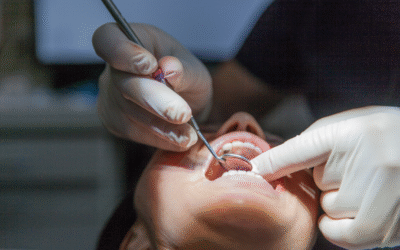 Oral Cancer Screening