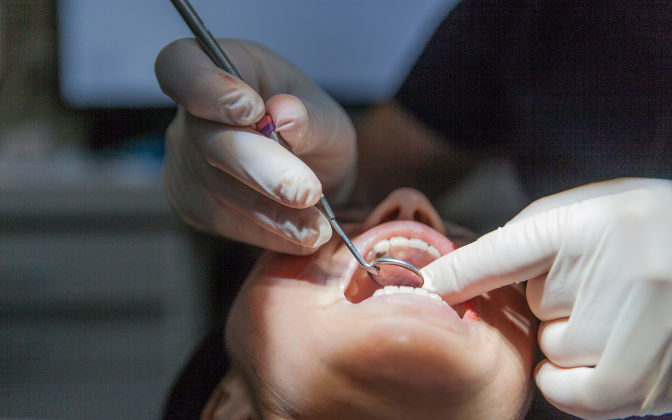 Oral Cancer Screening